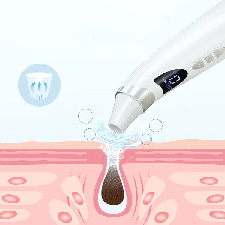 Electric Blackhead Remover | Pore Cleansing Tool
